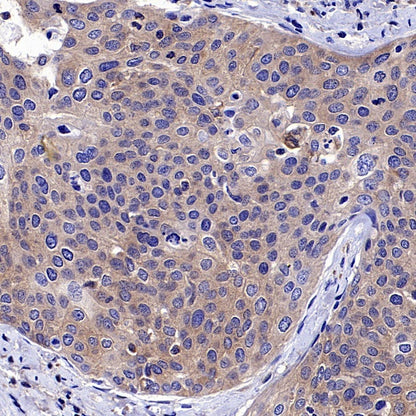 Hamartin/TSC1 Recombinant Rabbit mAb (S-2725-166)