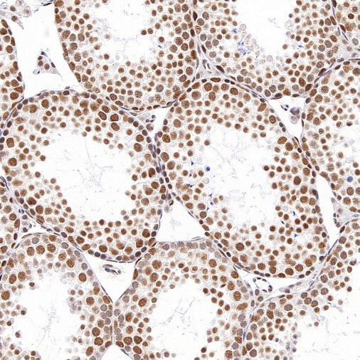 NR1D1 + NR1D2 / RVR Recombinant Rabbit mAb (S-5962)