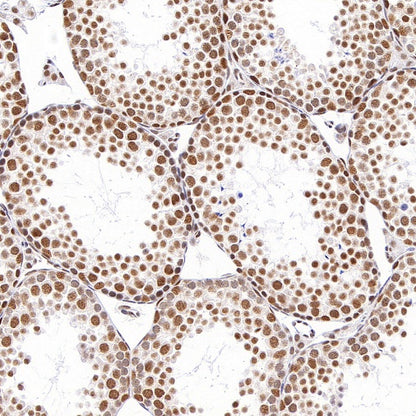 NR1D1 + NR1D2 / RVR Recombinant Rabbit mAb (S-5962)