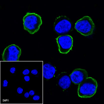 CD25/IL-2Rα Mouse mAb (S-573-1)