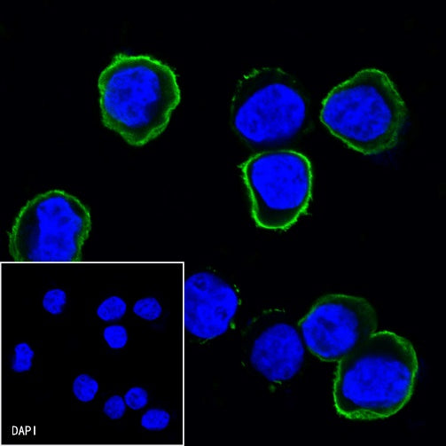 CD25/IL-2Rα Mouse mAb (S-573-1)