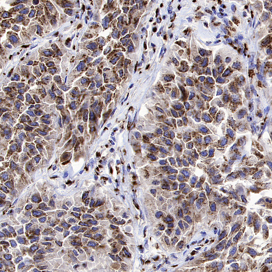 TGN46 Recombinant Rabbit mAb (S-3514-47)