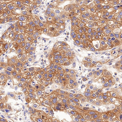 BRAF Recombinant Rabbit mAb (S-1328-60)
