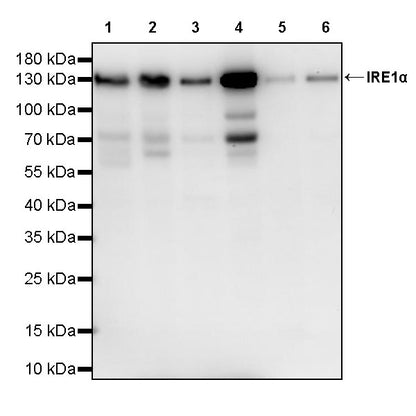 IRE1α Recombinant Rabbit mAb (S-3873-25)