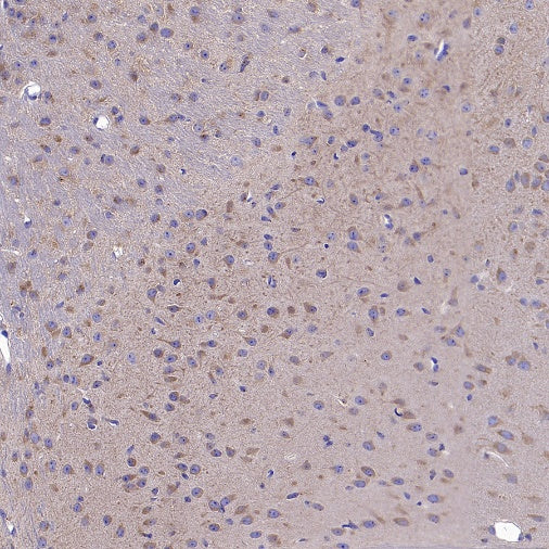 gamma Tubulin Recombinant Rabbit mAb (S-2204-13)