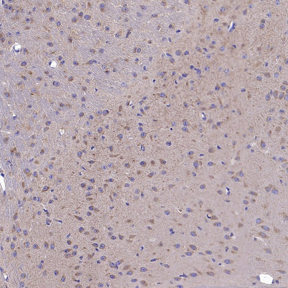 gamma Tubulin Recombinant Rabbit mAb (S-2204-13)