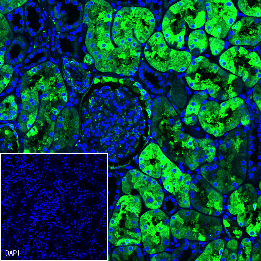 Alpha B Crystallin Recombinant Rabbit mAb (S-R216)