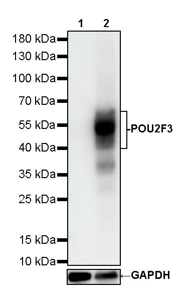 POU2F3 Recombinant Rabbit mAb (S-5525)
