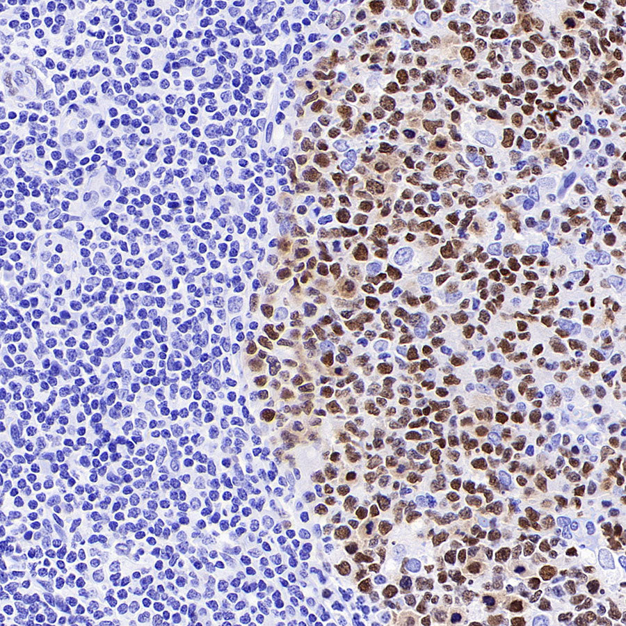 MEF2B Recombinant Rabbit mAb (S-3788-28)