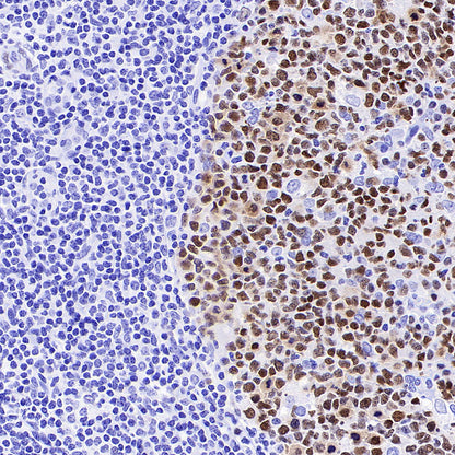 MEF2B Recombinant Rabbit mAb (S-3788-28)