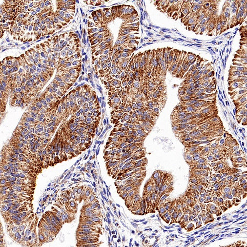 CPT1A Recombinant Rabbit mAb (S-1263-2)