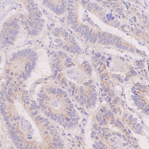 IRGQ Recombinant Rabbit mAb (S-2648-17)