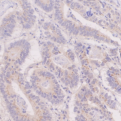 IRGQ Recombinant Rabbit mAb (S-2648-17)