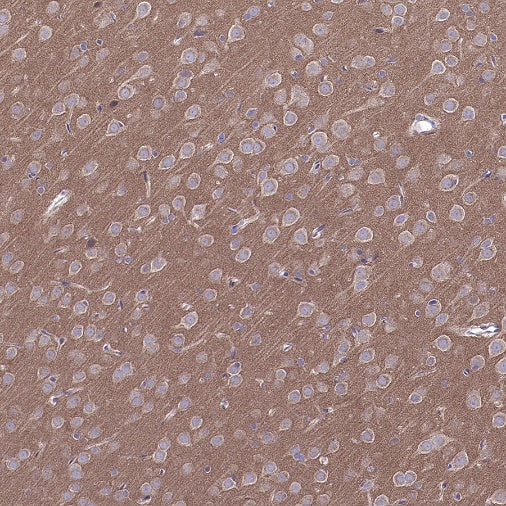 Atg13 Recombinant Rabbit mAb (S-2534-22)