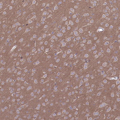 Atg13 Recombinant Rabbit mAb (S-2534-22)