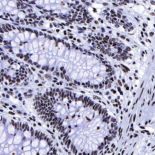Histone H3 (acetyl K27) Recombinant Rabbit mAb (S-699-50)