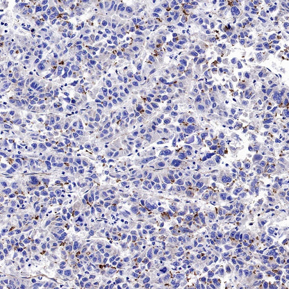 ZO-1 Recombinant Rabbit mAb