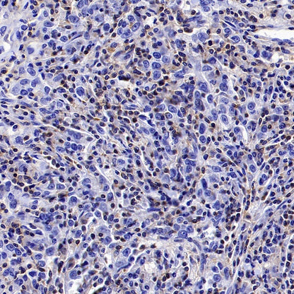 PIK3CD Recombinant Rabbit mAb (SDT-1978-148)