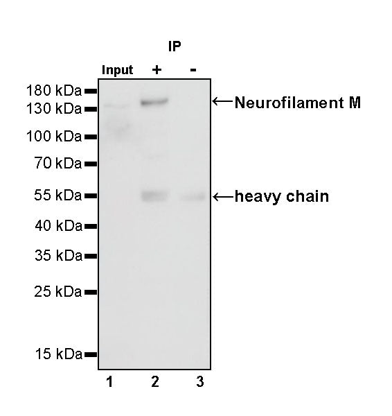 Neurofilament M Recombinant Rabbit mAb (S-501-31)