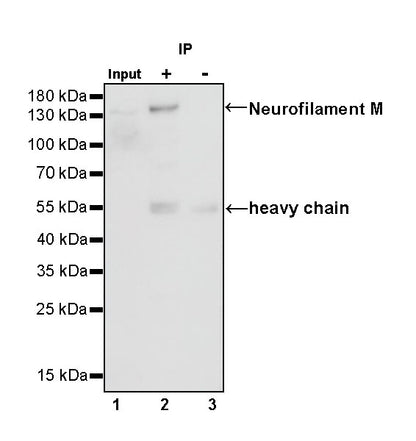 Neurofilament M Recombinant Rabbit mAb (S-501-31)
