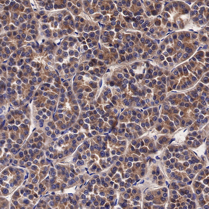 Galectin-3 Recombinant Rabbit mAb (SDT-370-111)