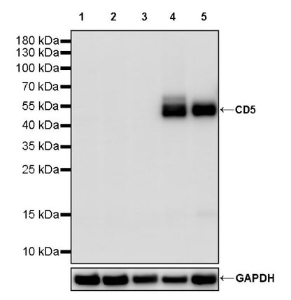 CD5 Recombinant Rabbit mAb (SDT-2857-16)