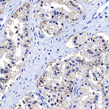 STEAP1+STEAP1B1+STEAP1B2 Recombinant Rabbit mAb (S-3226-137)