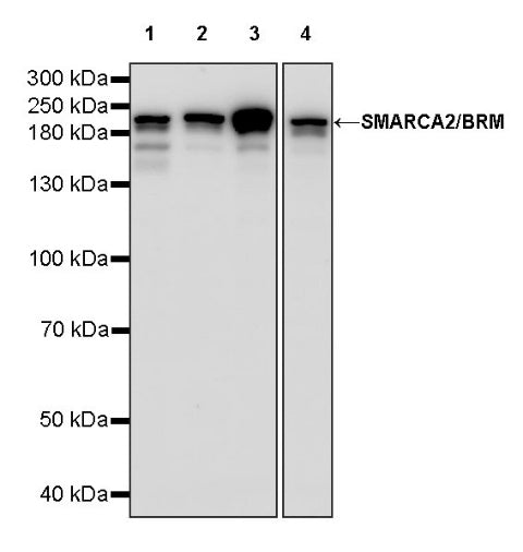 SMARCA2/BRM Recombinant Rabbit mAb (S-1568-17)