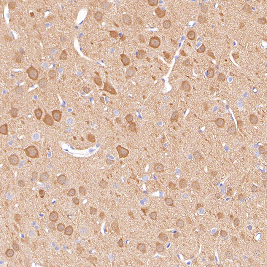 PGP9.5 Recombinant Mouse mAb (S-6071)