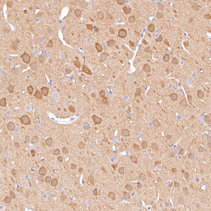 PGP9.5 Recombinant Mouse mAb (S-6071)