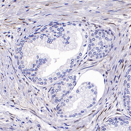 b-FGF/FGF2 Recombinant Rabbit mAb (S-1161-136)
