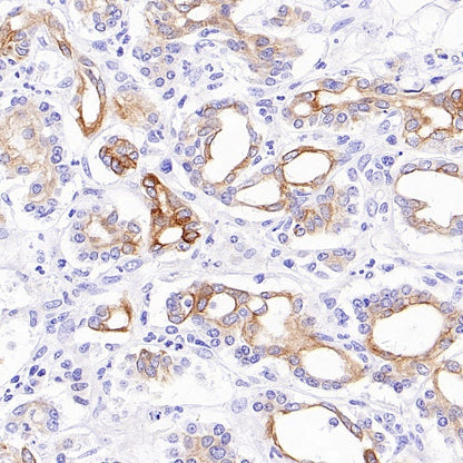 Jak1 Recombinant Rabbit mAb (S-4201)