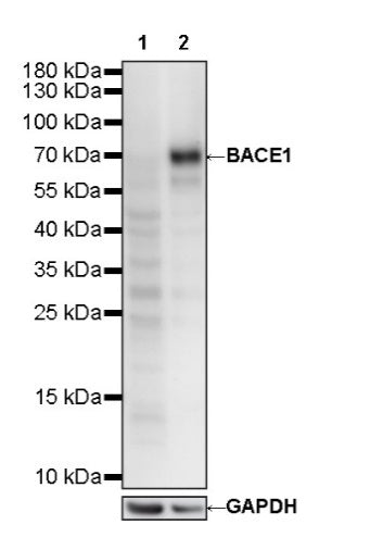 BACE1 Recombinant Rabbit mAb (S-2514-34)