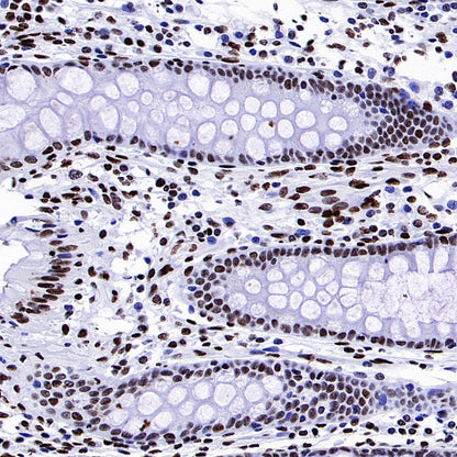 Histone H4 (acetyl K5 + K8 + K12 + K16) Recombinant Rabbit mAb (S-902-37)