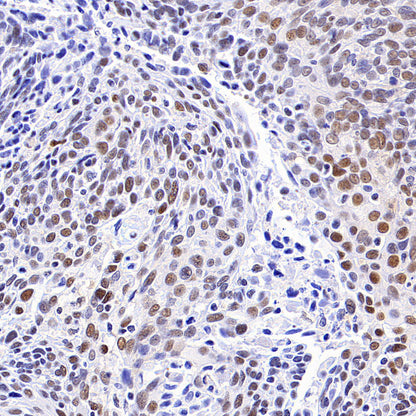 PAPSS1 Recombinant Rabbit mAb (S-3516-23)