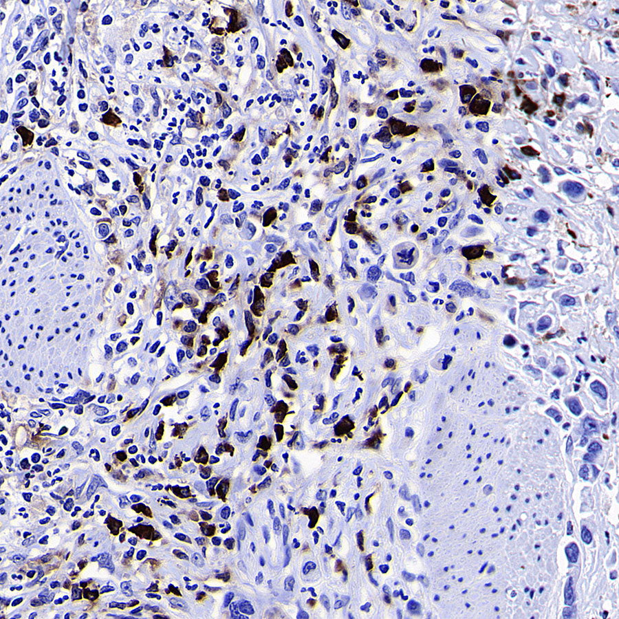HEG1 Recombinant Rabbit mAb (S-4419-64)