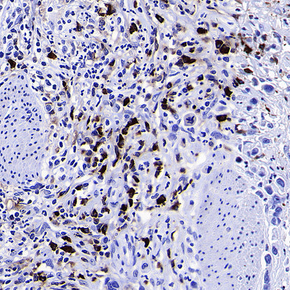 HEG1 Recombinant Rabbit mAb (S-4419-64)
