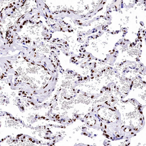Phospho-Histone H3 (Ser28) Recombinant Rabbit mAb (S-1025-45)