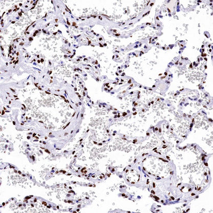 Phospho-Histone H3 (Ser28) Recombinant Rabbit mAb (S-1025-45)