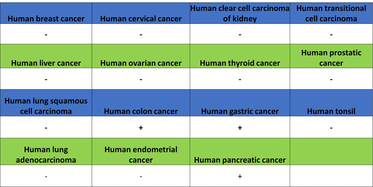 CDH17 Recombinant Rabbit mAb (SDT-3276-11)