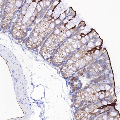 Ezrin Recombinant Rabbit mAb (S-R358)