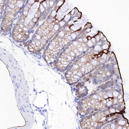 Ezrin Recombinant Rabbit mAb (S-R358)