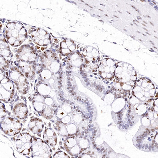 Nucleolin Rabbit Polyclonal Antibody