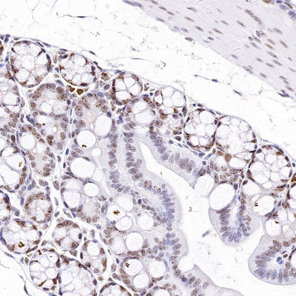 Nucleolin Rabbit Polyclonal Antibody