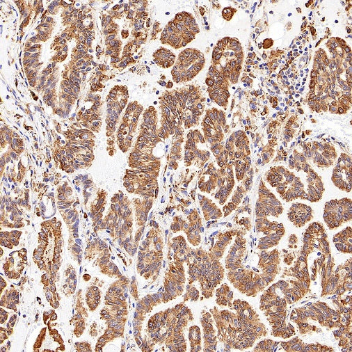 P4HB Recombinant Rabbit mAb (S-1524-120)