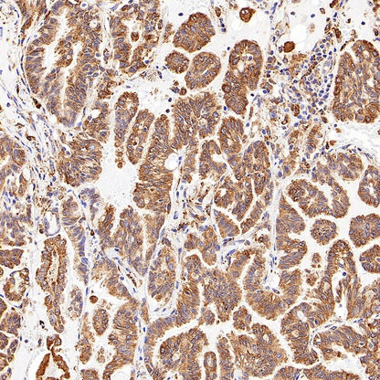 P4HB Recombinant Rabbit mAb (S-1524-120)
