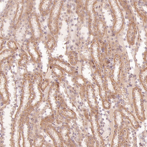 SFXN1/TCC Rabbit Polyclonal Antibody