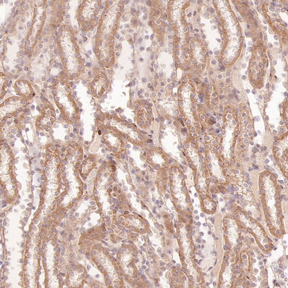 SFXN1/TCC Rabbit Polyclonal Antibody