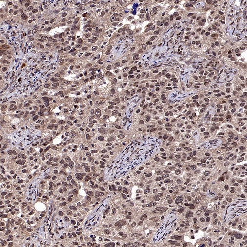DNA Ligase IV/LIG4 Recombinant Rabbit mAb (S-2237-118)