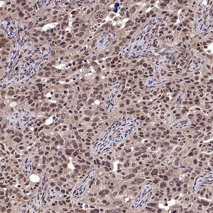 DNA Ligase IV/LIG4 Recombinant Rabbit mAb (S-2237-118)